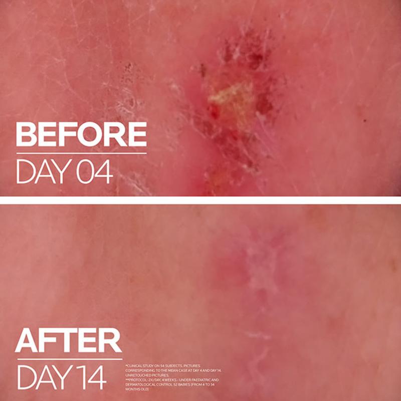 Cicaplast Baume B5+ Ultra Repairing Soothing Balm
